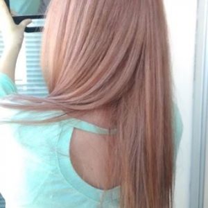 TANINOPLASTIA